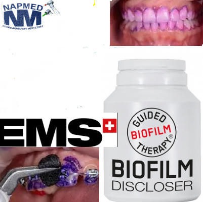 Biofilm Discloser – gąbki wybarwiające 250 szt. EMS